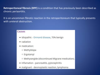 Retroperitoneal fibrosis (RPF) is a condition that has previously been described as
chronic periaortitis.
It is an uncommon fibrotic reaction in the retroperitoneum that typically presents
with ureteral obstruction.
 