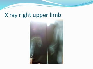 X ray right upper limb
 