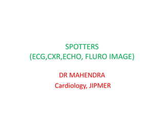 SPOTTERS
(ECG,CXR,ECHO, FLURO IMAGE)
DR MAHENDRA
Cardiology, JIPMER
 