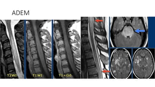 Radiology Spotters mixed Bag Collection for post graduates student .PPT