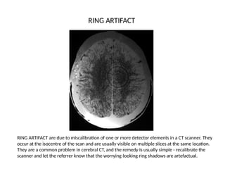 Spotters.pptx spotter radiography cxr ct mri | PPTX