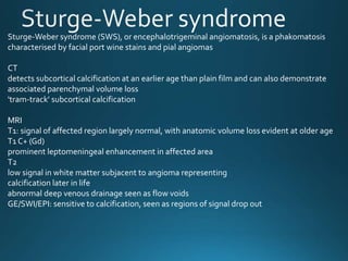 Sturge-Weber syndrome (SWS), or encephalotrigeminal angiomatosis, is a phakomatosis
characterised by facial port wine stains and pial angiomas
CT
detects subcortical calcification at an earlier age than plain film and can also demonstrate
associated parenchymal volume loss
'tram-track' subcortical calcification
MRI
T1: signal of affected region largely normal, with anatomic volume loss evident at older age
T1 C+ (Gd)
prominent leptomeningeal enhancement in affected area
T2
low signal in white matter subjacent to angioma representing
calcification later in life
abnormal deep venous drainage seen as flow voids
GE/SWI/EPI: sensitive to calcification, seen as regions of signal drop out
 