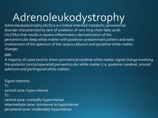 Adrenoleukodystrophy (ALD) is a x-linked inherited metabolic peroxisomal
disorder characterised by lack of oxidation of very long chain fatty acids
(VLCFAs) that results in severe inflammatory demyelination of the
periventricular deep white matter with posterior-predominant pattern and early
involvement of the splenium of the corpus callosum and periatrial white matter
changes
MRI
A majority of cases tend to show symmetrical cerebral white matter signal change involving
the posterior (occipitoparietal) periventricular white matter (i.e. posterior cerebral, around
splenium and peritrigonal white matter).
Signal intensity
T1
central zone: hypo-intense
T2
central zone: markedly hyperintense
intermediate zone: isointense to hypointense
peripheral zone: moderately hypointense
 