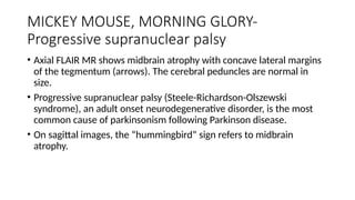 Key Neuroradiology Signs and Their Clinical Implications in CNS ...