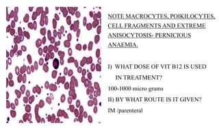 NOTE MACROCYTES, POIKILOCYTES,
CELL FRAGMENTS AND EXTREME
ANISOCYTOSIS- PERNICIOUS
ANAEMIA.
I) WHAT DOSE OF VIT B12 IS USE...