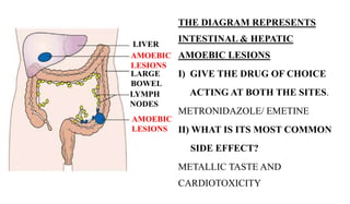 THE DIAGRAM REPRESENTS
INTESTINAL & HEPATIC
AMOEBIC LESIONS
I) GIVE THE DRUG OF CHOICE
ACTING AT BOTH THE SITES.
METRONIDA...
