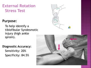 SPRAINED ANKLE | PPTX
