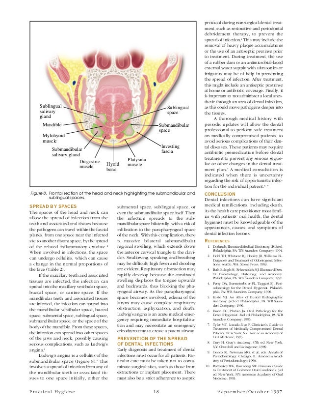 Spread of dental infection pdf