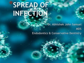 Dr. Abhishek John Samuel
MDS
Endodontics & Conservative Dentistry
*SPREAD OF
INFECTION
 