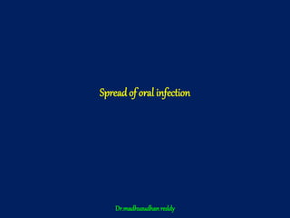 Spread of oral infection
Dr.madhusudhanreddy
 