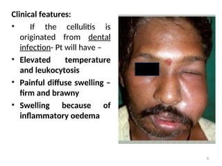 SPREAD OF ORAL INFECTIONS BDS 3rd YEAR CLASS PPT.ppt