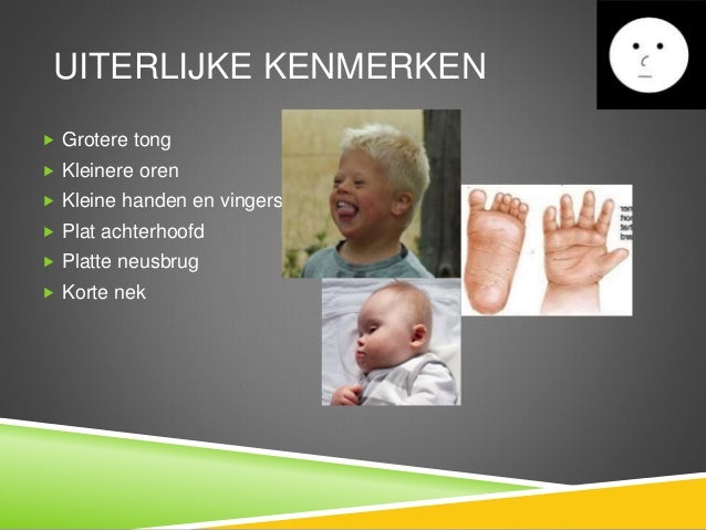 Spreekbeurt downsyndroom