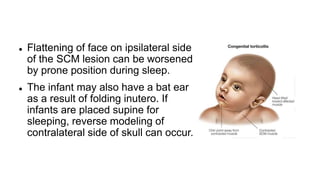 Spangles Defect Sprengel deformity presentation by doctor | PPTX