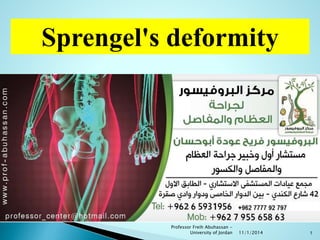 Sprengel's deformity 
11/1/2014 
Professor Freih Abuhassan - 
University of Jordan 1 
 