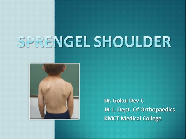 SPRENGEL SHOULDER.pptx | Death, Injury, or Military Conflict ...