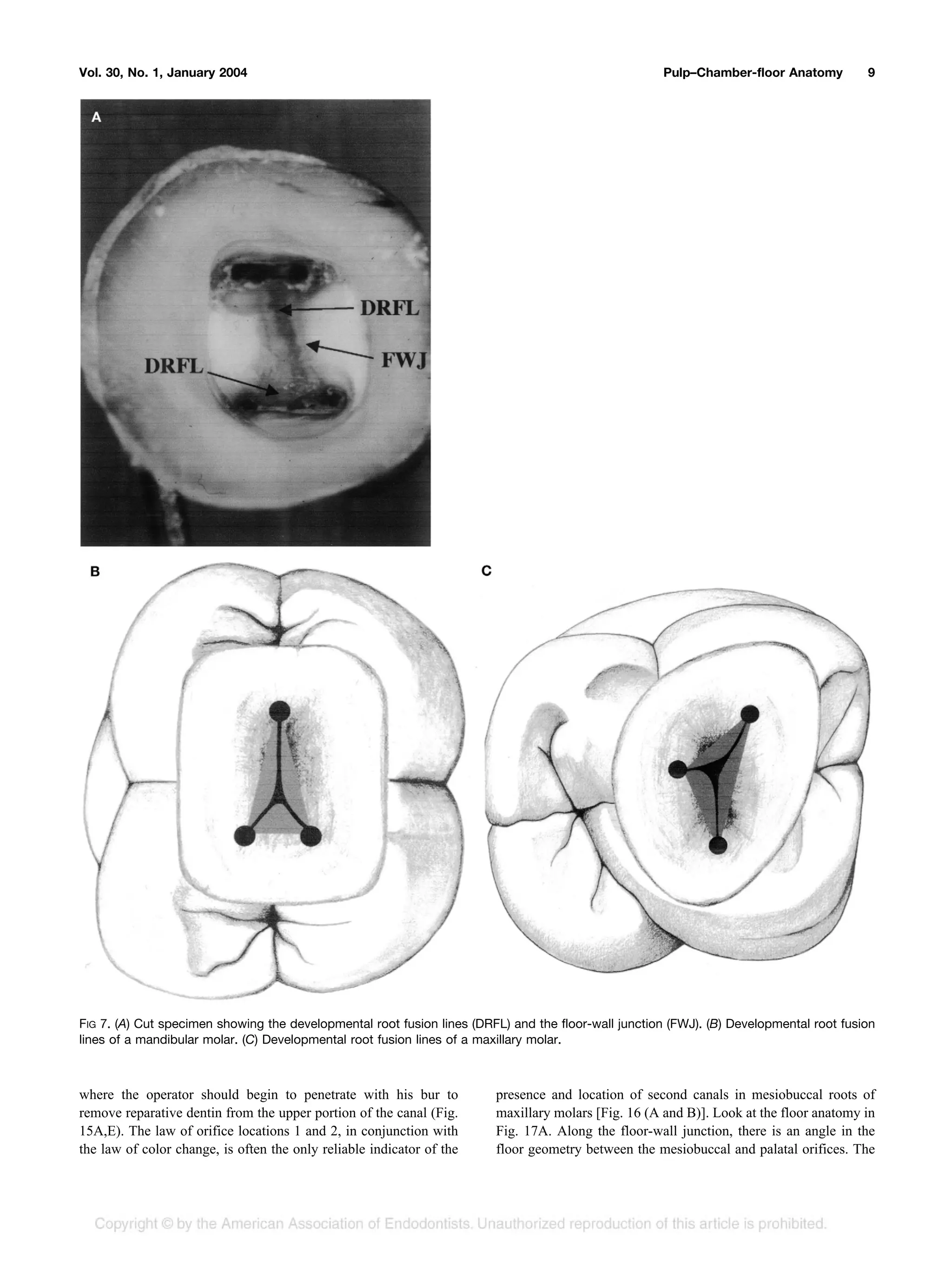 Pulp Operator anatomy of the pulp-chamber floor | PDF