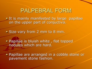 PALPEBRAL FORM
It is mainly manifested by large papillae
on the upper part of conjuctiva.
Size vary from 2 mm to 8 mm.
Papillae is bluish white , flat topped
nodules which are hard.
Papillae are arranged in a cobble stone or
pavement stone fashion.
 