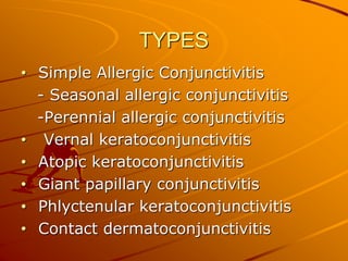 TYPES
• Simple Allergic Conjunctivitis
- Seasonal allergic conjunctivitis
-Perennial allergic conjunctivitis
• Vernal keratoconjunctivitis
• Atopic keratoconjunctivitis
• Giant papillary conjunctivitis
• Phlyctenular keratoconjunctivitis
• Contact dermatoconjunctivitis
 
