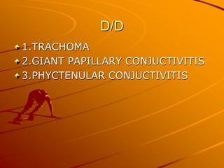 D/D
1.TRACHOMA
2.GIANT PAPILLARY CONJUCTIVITIS
3.PHYCTENULAR CONJUCTIVITIS
 