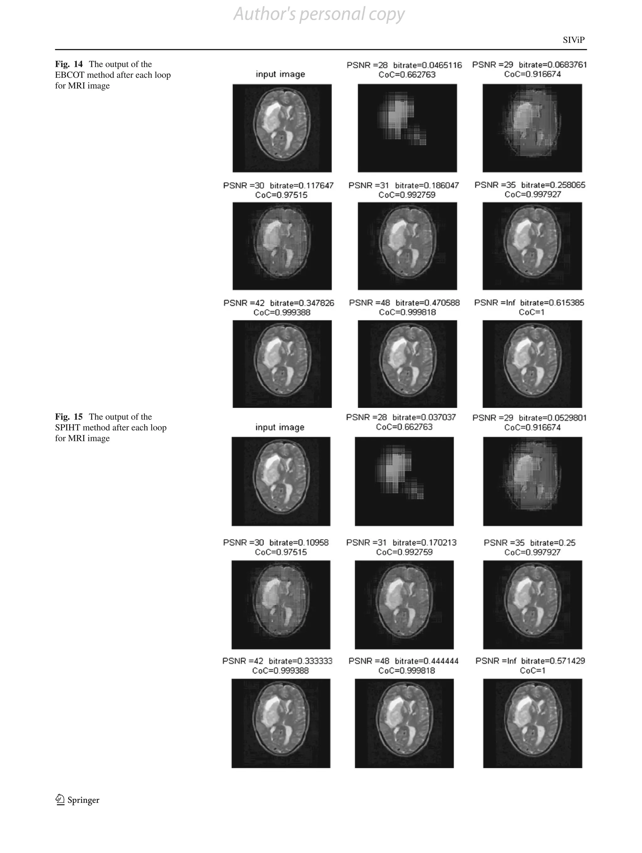 Author's personal copy
                                                        SIViP

Fig. 14 The output of the
EBCOT method after each loop
for MRI image




Fig. 15 The output of the
SPIHT method after each loop
for MRI image




123
 