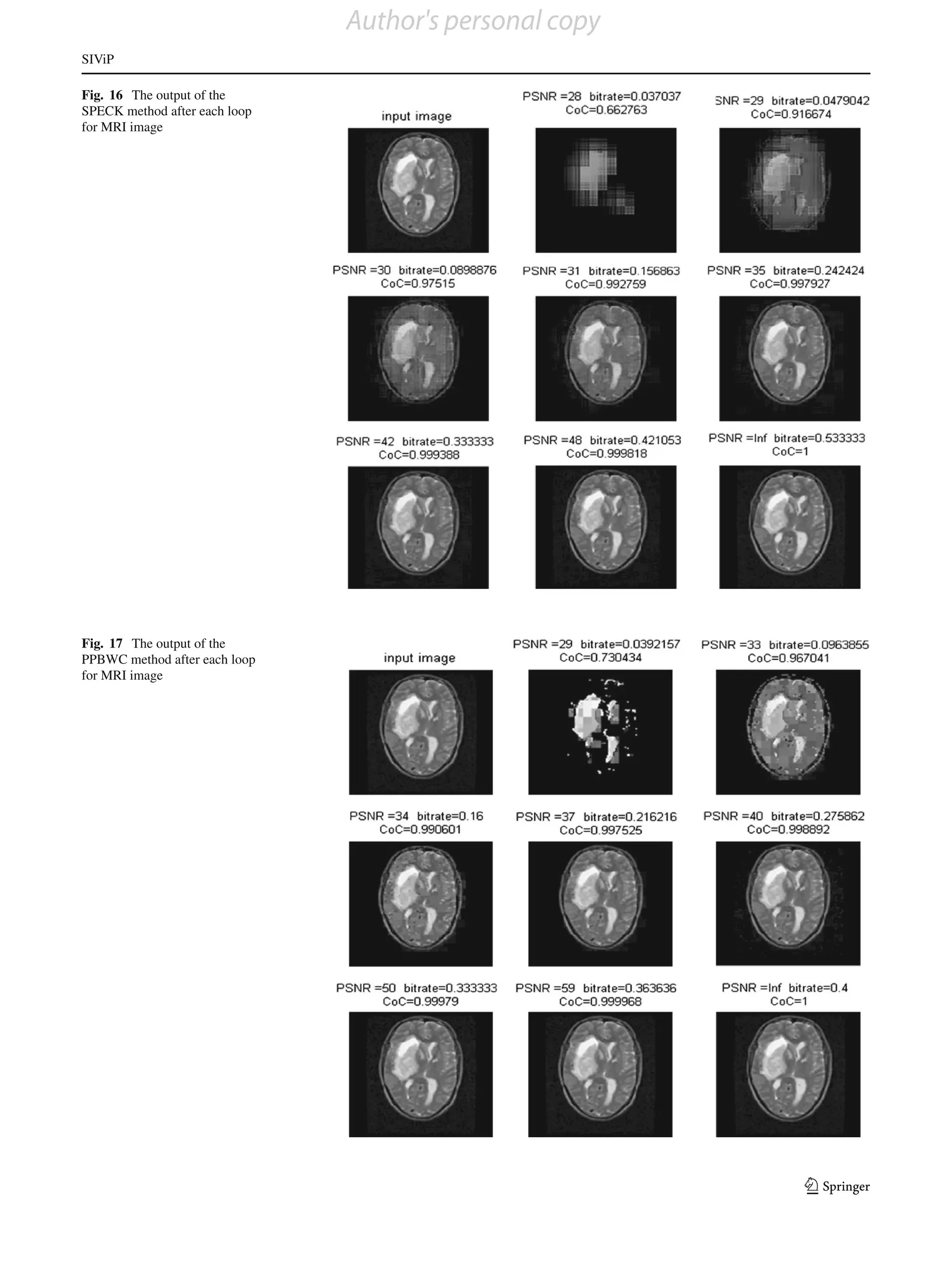 Author's personal copy
SIViP

Fig. 16 The output of the
SPECK method after each loop
for MRI image




Fig. 17 The output of the
PPBWC method after each loop
for MRI image




                                                        123
 