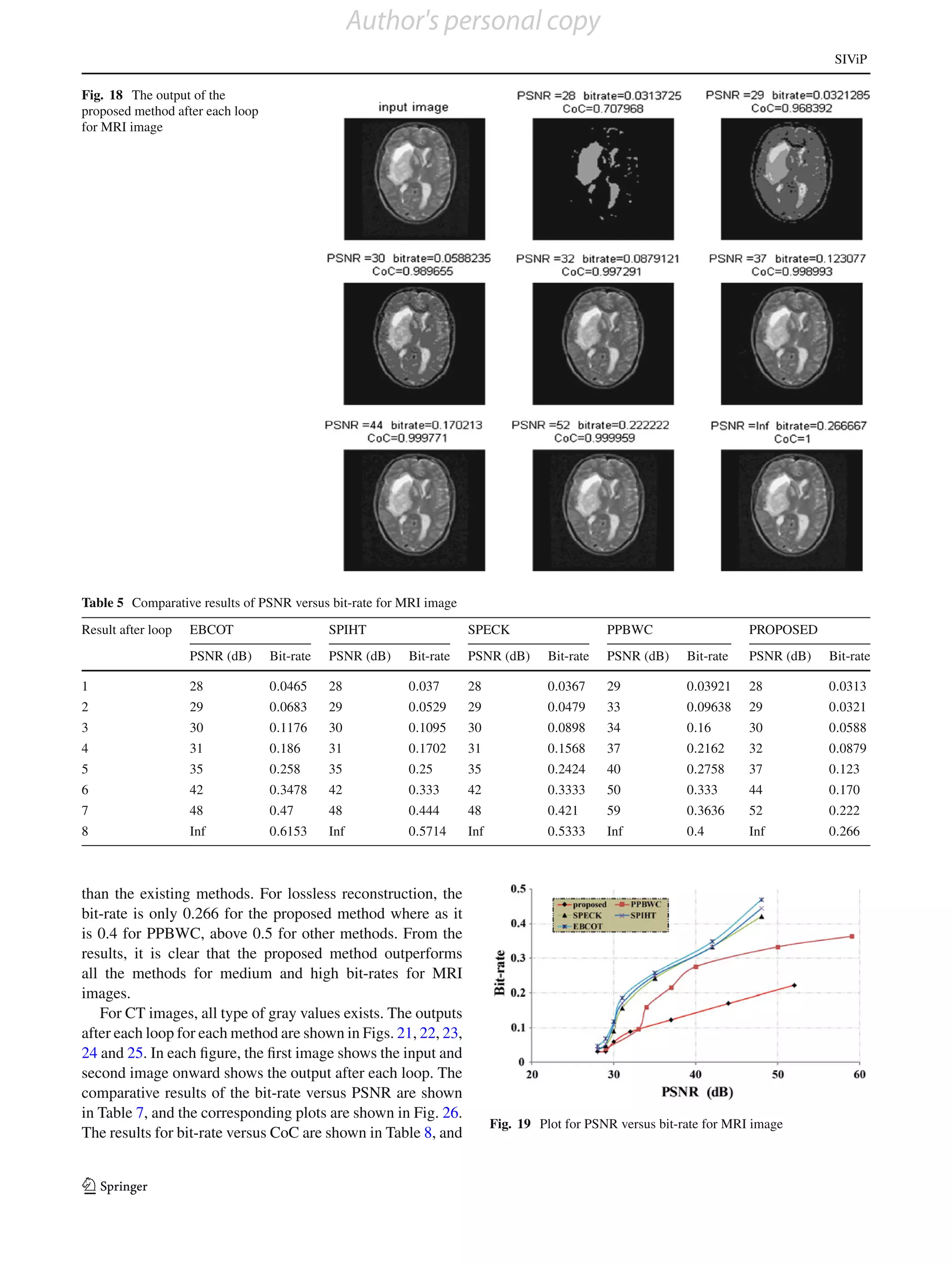 Author's personal copy
                                                                                                                                    SIViP

Fig. 18 The output of the
proposed method after each loop
for MRI image




Table 5 Comparative results of PSNR versus bit-rate for MRI image
Result after loop   EBCOT                    SPIHT                  SPECK                      PPBWC                   PROPOSED
                    PSNR (dB)     Bit-rate   PSNR (dB)   Bit-rate   PSNR (dB)       Bit-rate   PSNR (dB)    Bit-rate   PSNR (dB)   Bit-rate

1                   28            0.0465     28          0.037      28              0.0367     29           0.03921    28          0.0313
2                   29            0.0683     29          0.0529     29              0.0479     33           0.09638    29          0.0321
3                   30            0.1176     30          0.1095     30              0.0898     34           0.16       30          0.0588
4                   31            0.186      31          0.1702     31              0.1568     37           0.2162     32          0.0879
5                   35            0.258      35          0.25       35              0.2424     40           0.2758     37          0.123
6                   42            0.3478     42          0.333      42              0.3333     50           0.333      44          0.170
7                   48            0.47       48          0.444      48              0.421      59           0.3636     52          0.222
8                   Inf           0.6153     Inf         0.5714     Inf             0.5333     Inf          0.4        Inf         0.266



than the existing methods. For lossless reconstruction, the
bit-rate is only 0.266 for the proposed method where as it
is 0.4 for PPBWC, above 0.5 for other methods. From the
results, it is clear that the proposed method outperforms
all the methods for medium and high bit-rates for MRI
images.
   For CT images, all type of gray values exists. The outputs
after each loop for each method are shown in Figs. 21, 22, 23,
24 and 25. In each ﬁgure, the ﬁrst image shows the input and
second image onward shows the output after each loop. The
comparative results of the bit-rate versus PSNR are shown
in Table 7, and the corresponding plots are shown in Fig. 26.
                                                                          Fig. 19 Plot for PSNR versus bit-rate for MRI image
The results for bit-rate versus CoC are shown in Table 8, and


123
 