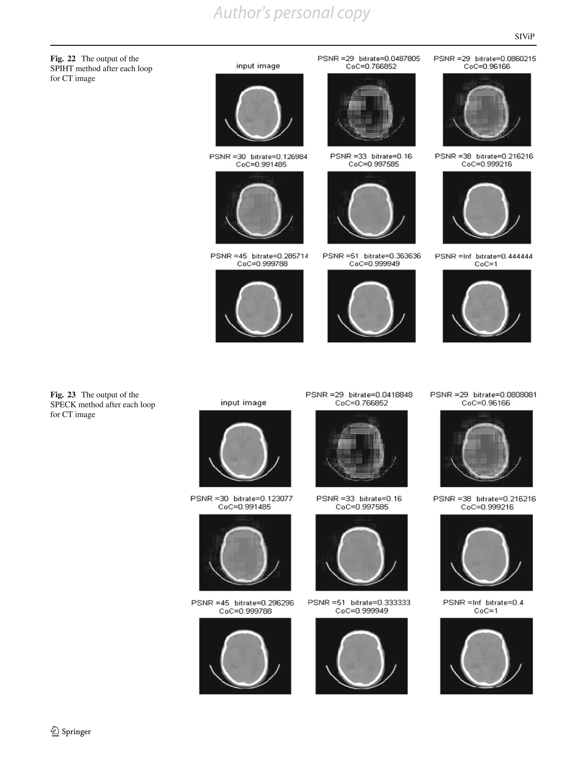 Author's personal copy
                                                        SIViP

Fig. 22 The output of the
SPIHT method after each loop
for CT image




Fig. 23 The output of the
SPECK method after each loop
for CT image




123
 