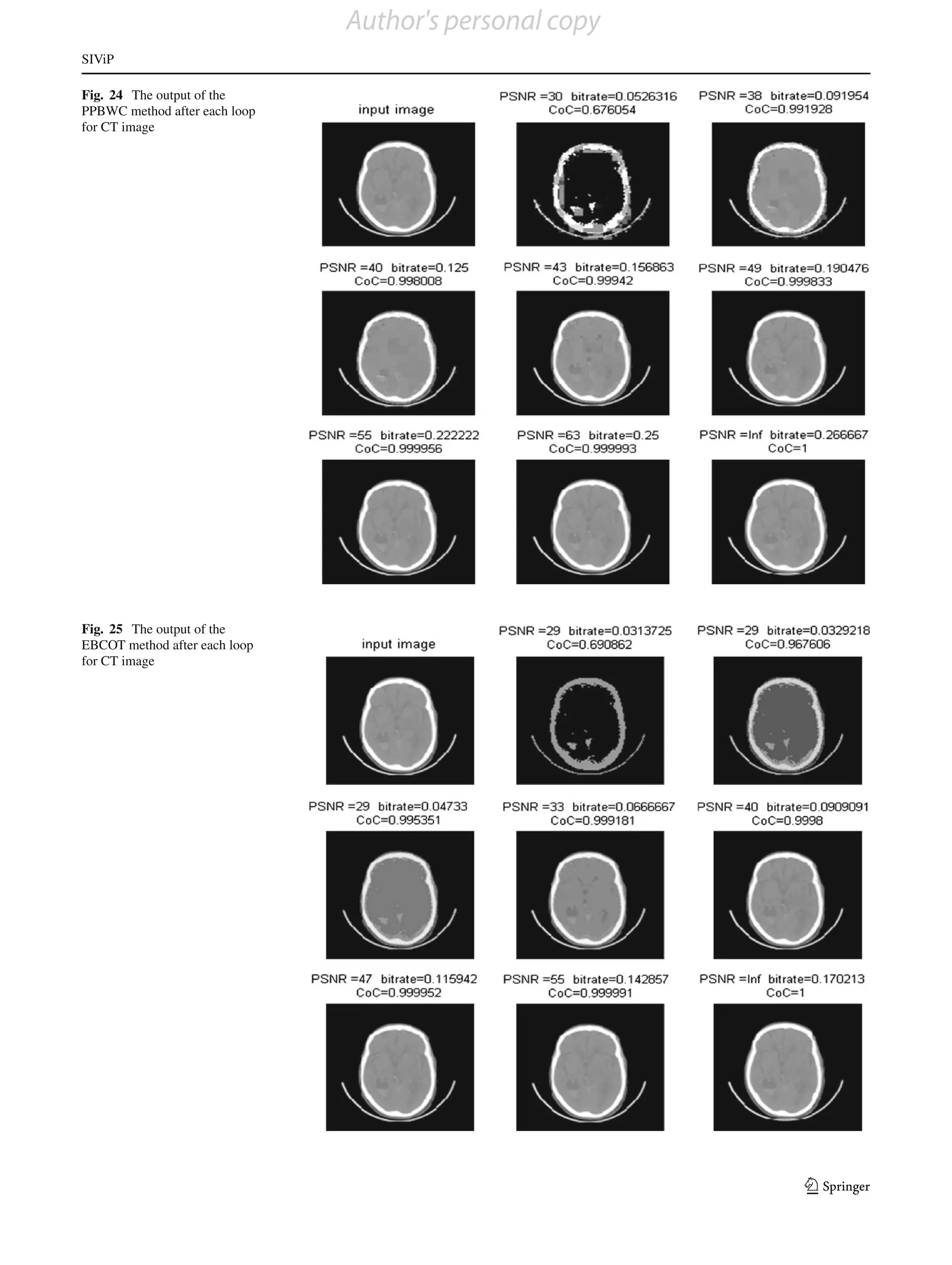 Author's personal copy
SIViP

Fig. 24 The output of the
PPBWC method after each loop
for CT image




Fig. 25 The output of the
EBCOT method after each loop
for CT image




                                                        123
 