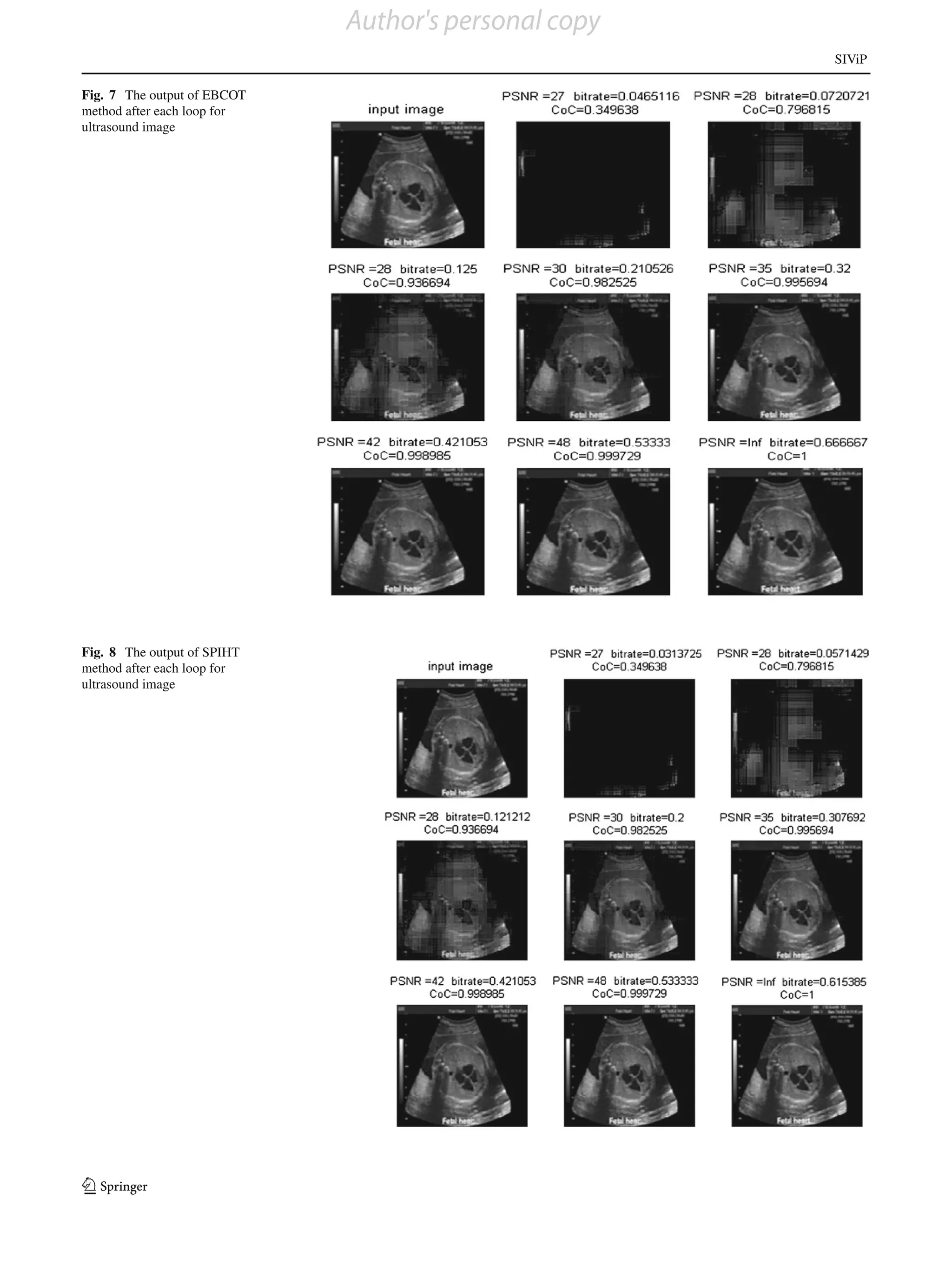 Author's personal copy
                                                      SIViP

Fig. 7 The output of EBCOT
method after each loop for
ultrasound image




Fig. 8 The output of SPIHT
method after each loop for
ultrasound image




123
 