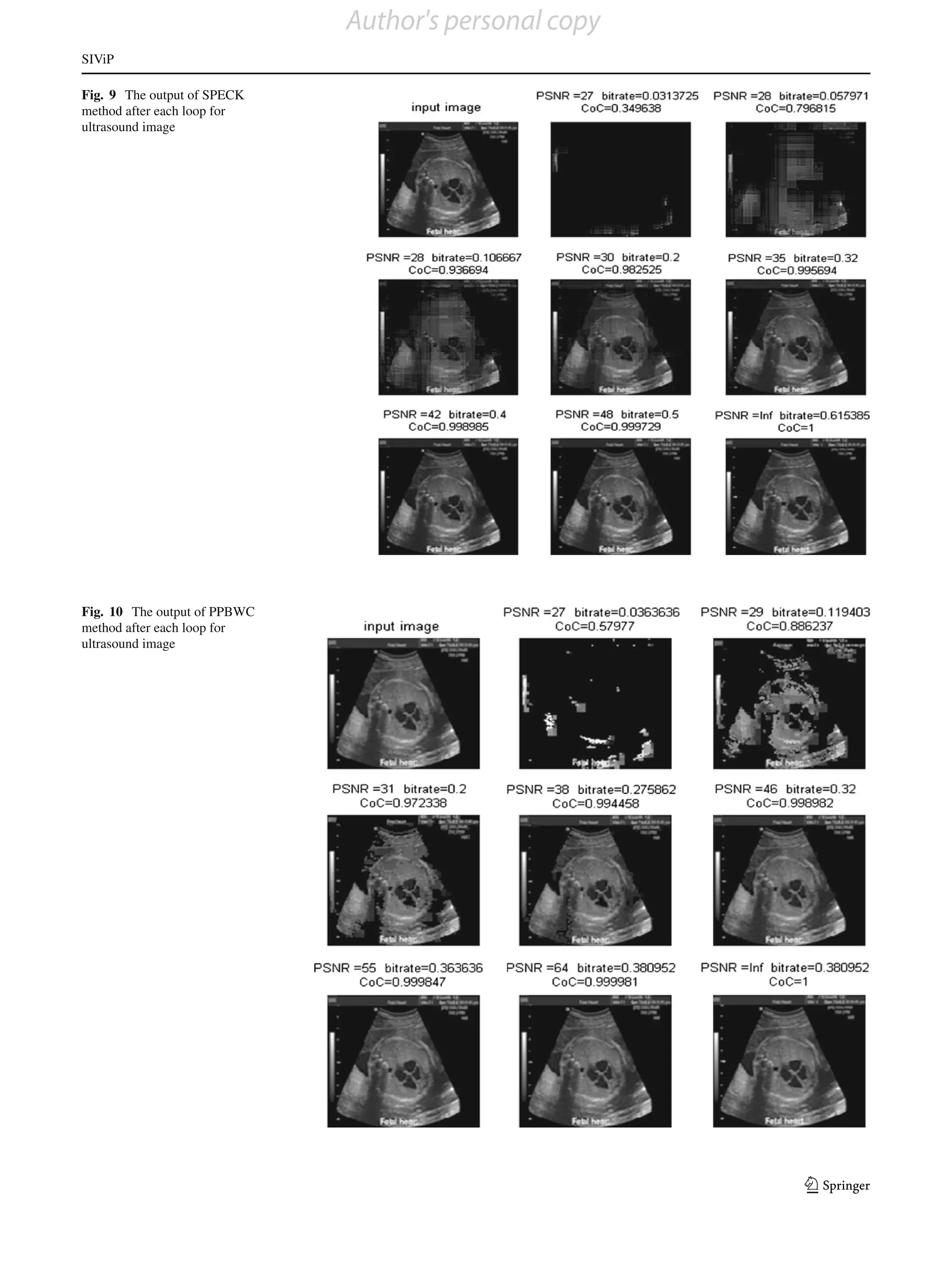 Author's personal copy
SIViP

Fig. 9 The output of SPECK
method after each loop for
ultrasound image




Fig. 10 The output of PPBWC
method after each loop for
ultrasound image




                                                       123
 