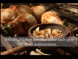 500,000 children become blind each year
from malnutrition.
 