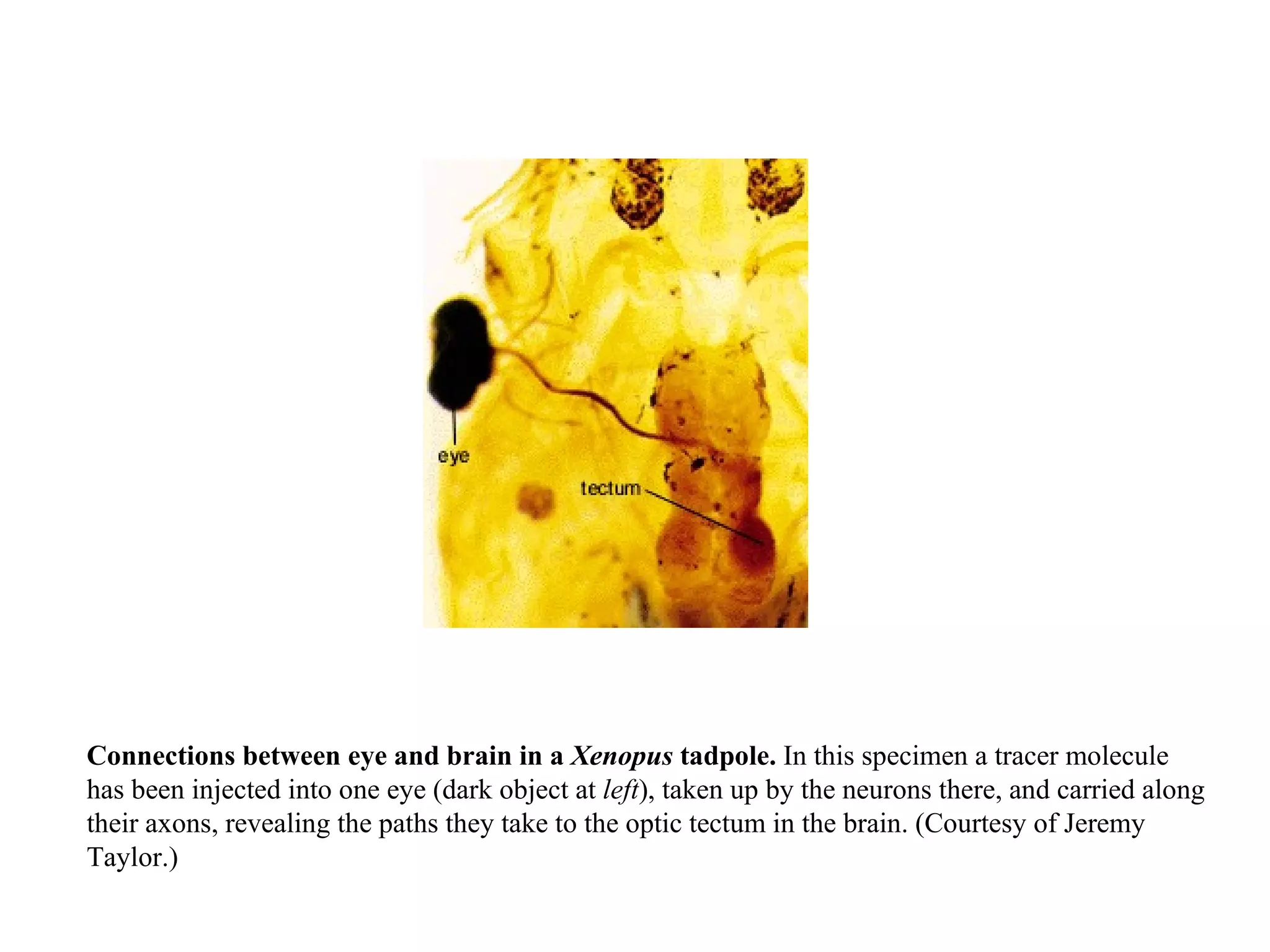 Connections between eye and brain in a  Xenopus  tadpole.  In this specimen a tracer molecule has been injected into one eye (dark object at  left ), taken up by the neurons there, and carried along their axons, revealing the paths they take to the optic tectum in the brain. (Courtesy of Jeremy Taylor.) 