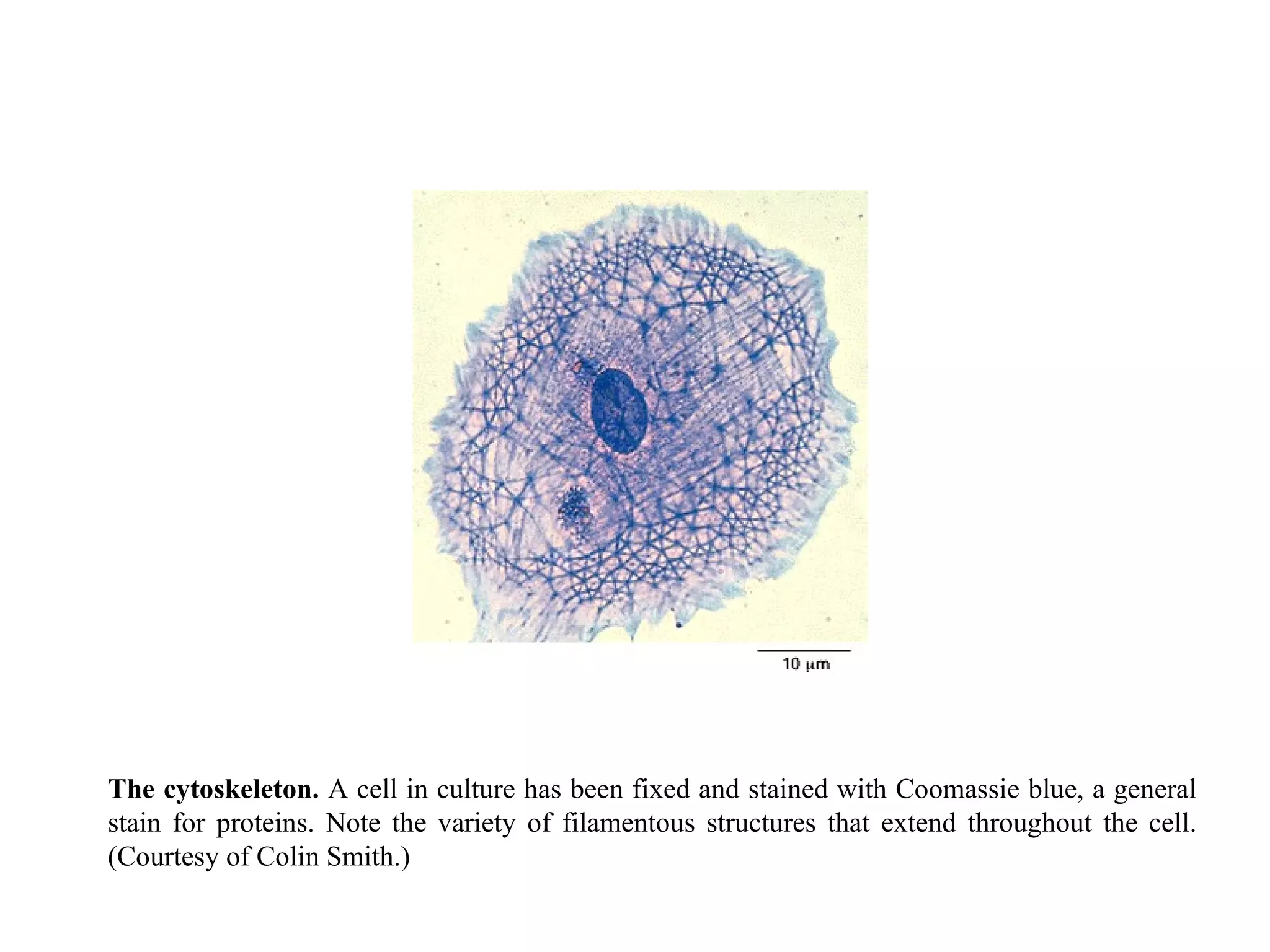 The cytoskeleton.  A cell in culture has been fixed and stained with Coomassie blue, a general stain for proteins. Note the variety of filamentous structures that extend throughout the cell. (Courtesy of Colin Smith.) 