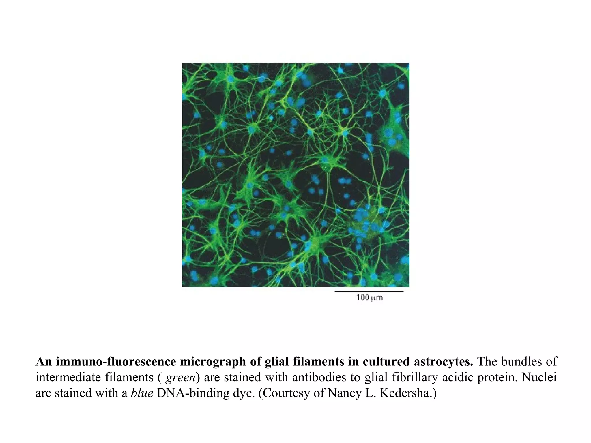 An immuno-fluorescence micrograph of glial filaments in cultured astrocytes.  The bundles of intermediate filaments (  green ) are stained with antibodies to glial fibrillary acidic protein. Nuclei are stained with a  blue  DNA-binding dye. (Courtesy of Nancy L. Kedersha.) 