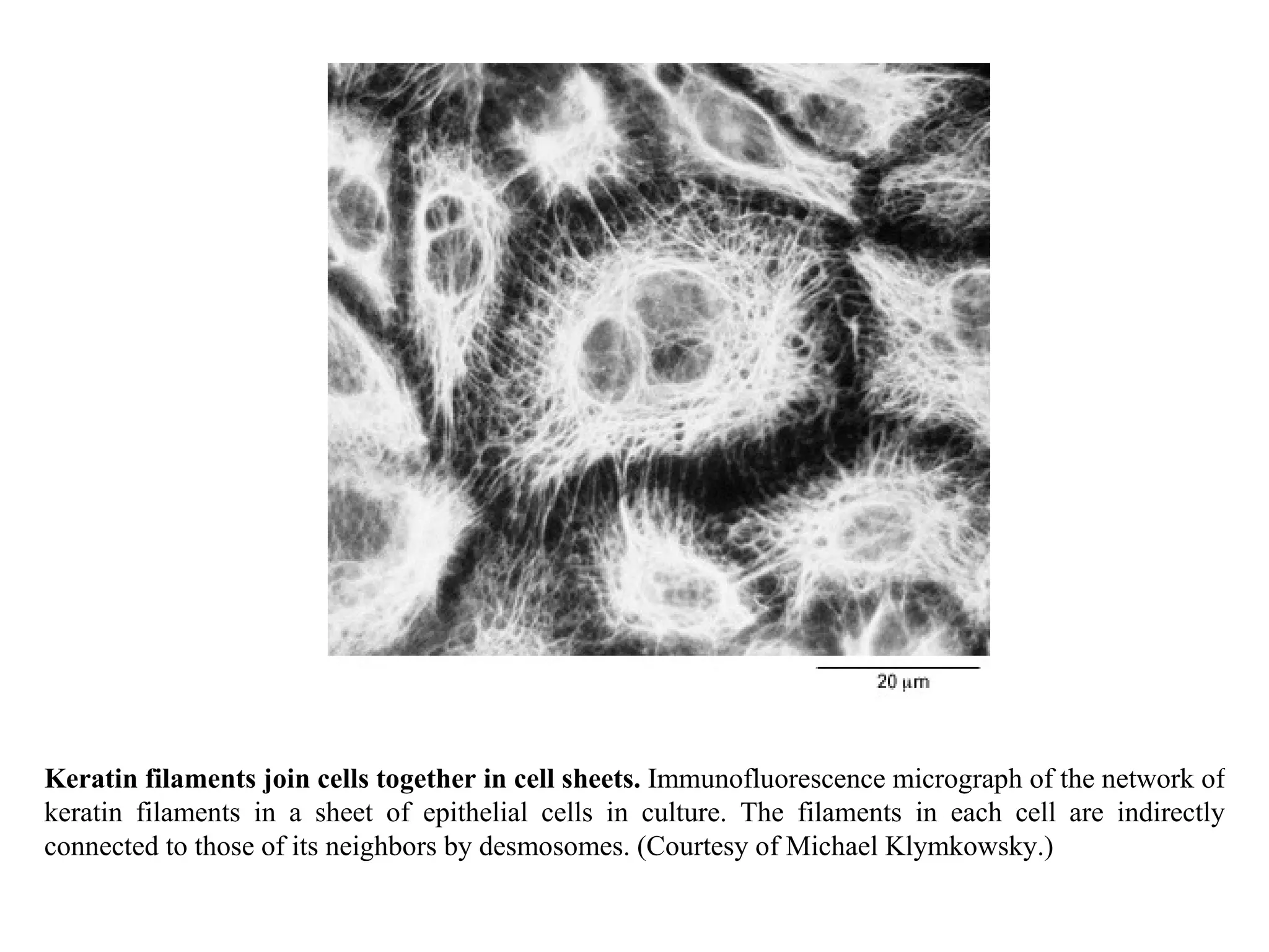 Keratin filaments join cells together in cell sheets.  Immunofluorescence micrograph of the network of keratin filaments in a sheet of epithelial cells in culture. The filaments in each cell are indirectly connected to those of its neighbors by desmosomes. (Courtesy of Michael Klymkowsky.) 