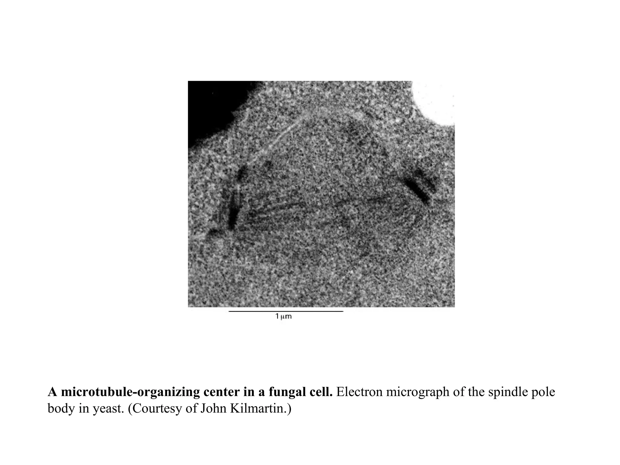A microtubule-organizing center in a fungal cell.  Electron micrograph of the spindle pole body in yeast. (Courtesy of John Kilmartin.) 