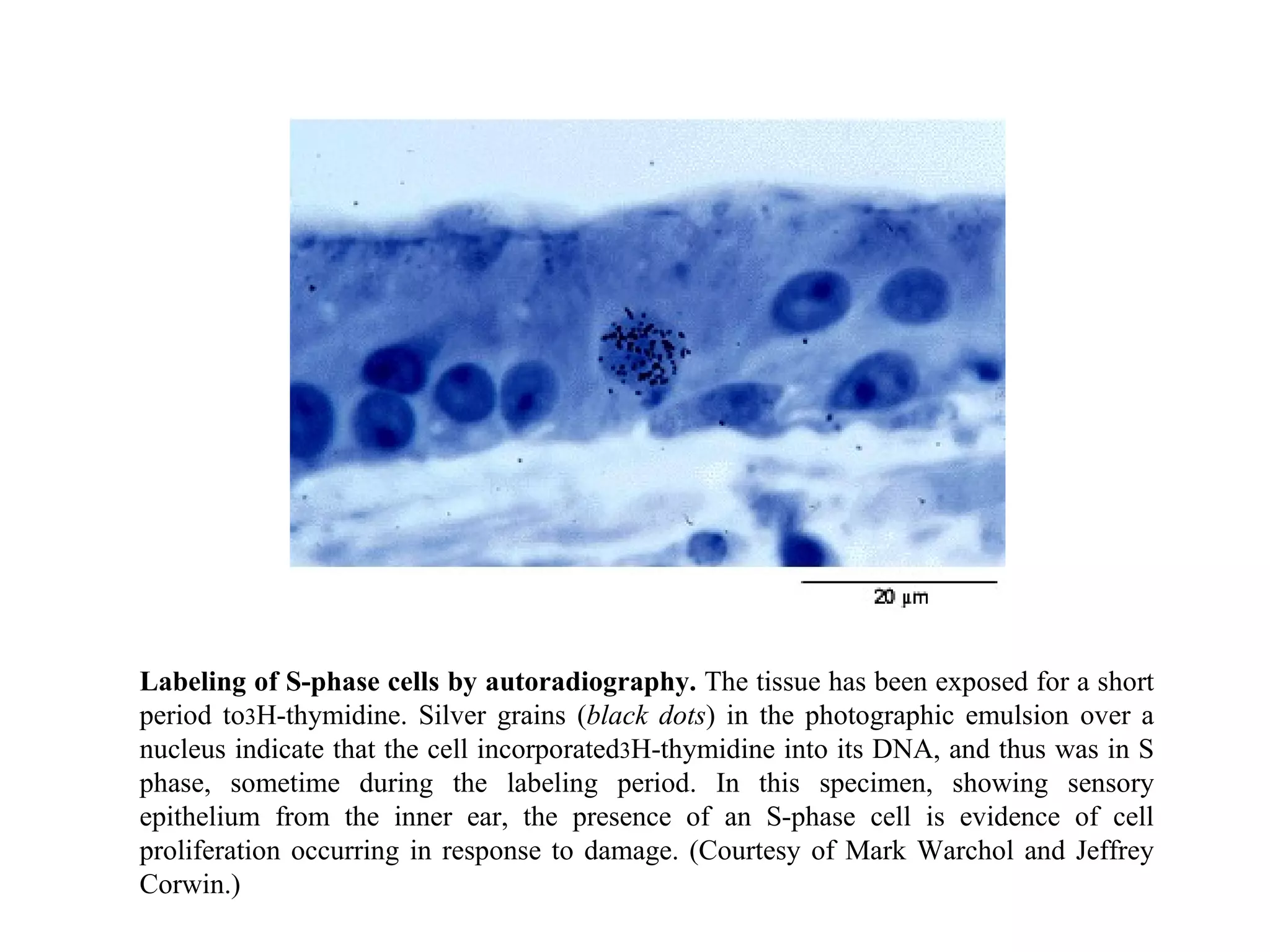 Labeling of S-phase cells by autoradiography.  The tissue has been exposed for a short period to 3 H-thymidine. Silver grains ( black dots ) in the photographic emulsion over a nucleus indicate that the cell incorporated 3 H-thymidine into its DNA, and thus was in S phase, sometime during the labeling period. In this specimen, showing sensory epithelium from the inner ear, the presence of an S-phase cell is evidence of cell proliferation occurring in response to damage. (Courtesy of Mark Warchol and Jeffrey Corwin.) 