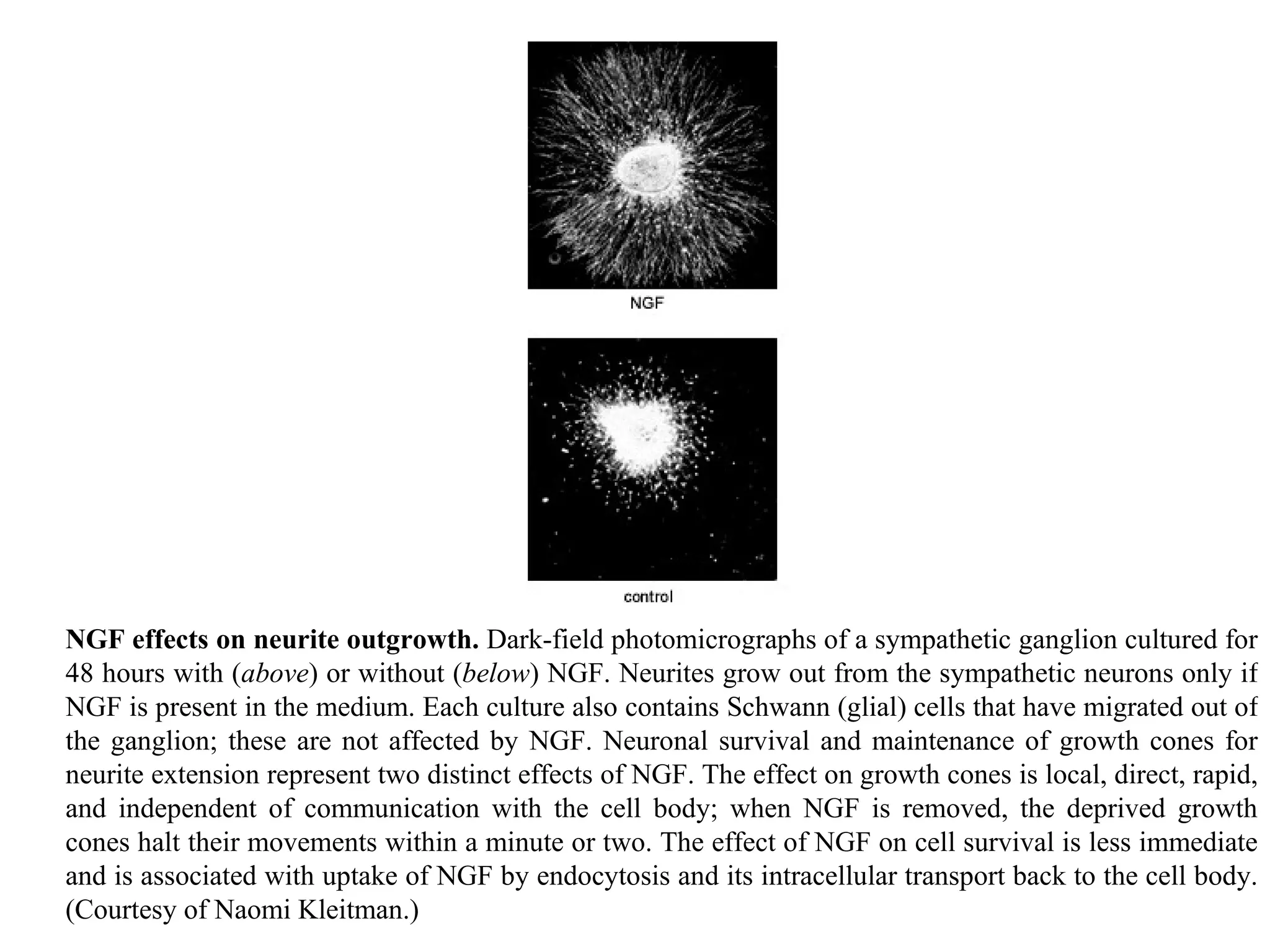 NGF effects on neurite outgrowth.  Dark-field photomicrographs of a sympathetic ganglion cultured for 48 hours with ( above ) or without ( below ) NGF. Neurites grow out from the sympathetic neurons only if NGF is present in the medium. Each culture also contains Schwann (glial) cells that have migrated out of the ganglion; these are not affected by NGF. Neuronal survival and maintenance of growth cones for neurite extension represent two distinct effects of NGF. The effect on growth cones is local, direct, rapid, and independent of communication with the cell body; when NGF is removed, the deprived growth cones halt their movements within a minute or two. The effect of NGF on cell survival is less immediate and is associated with uptake of NGF by endocytosis and its intracellular transport back to the cell body. (Courtesy of Naomi Kleitman.) 