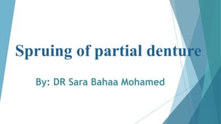 Spruing of partial denture
By: DR Sara Bahaa Mohamed
 