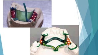 Sprue Radiology spruing.pptx