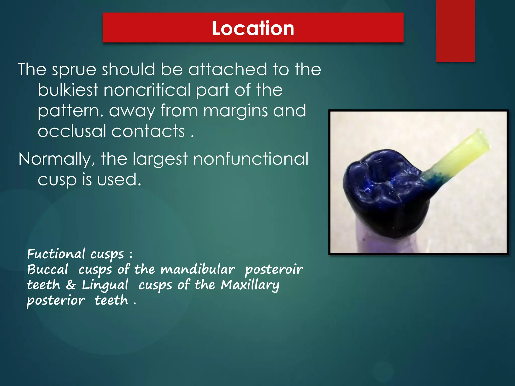 Location
The sprue should be attached to the
bulkiest noncritical part of the
pattern. away from margins and
occlusal contacts .
Normally, the largest nonfunctional
cusp is used.

Fuctional cusps :
Buccal cusps of the mandibular posteroir
teeth & Lingual cusps of the Maxillary
posterior teeth .

 