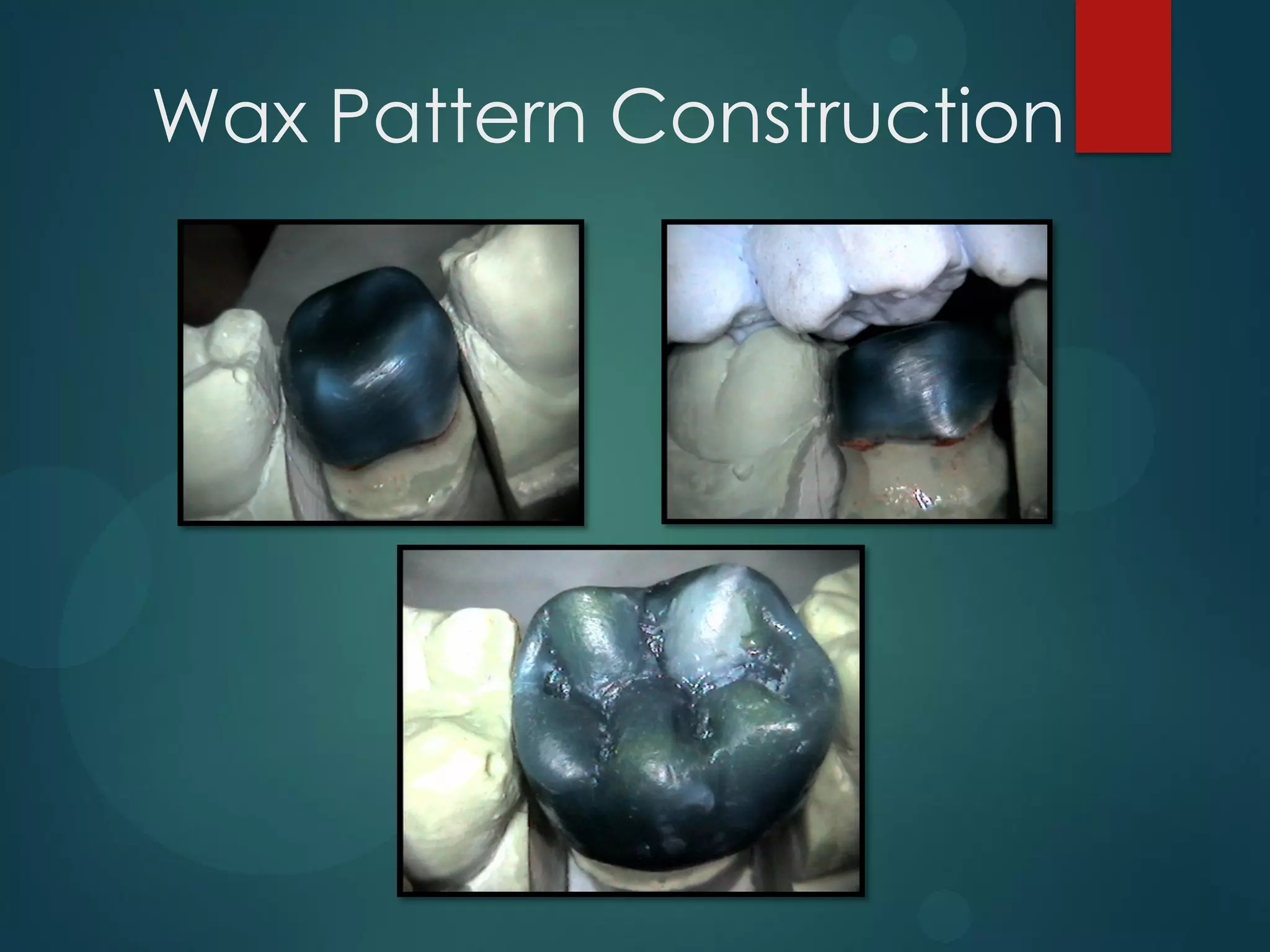 Wax Pattern Construction

 