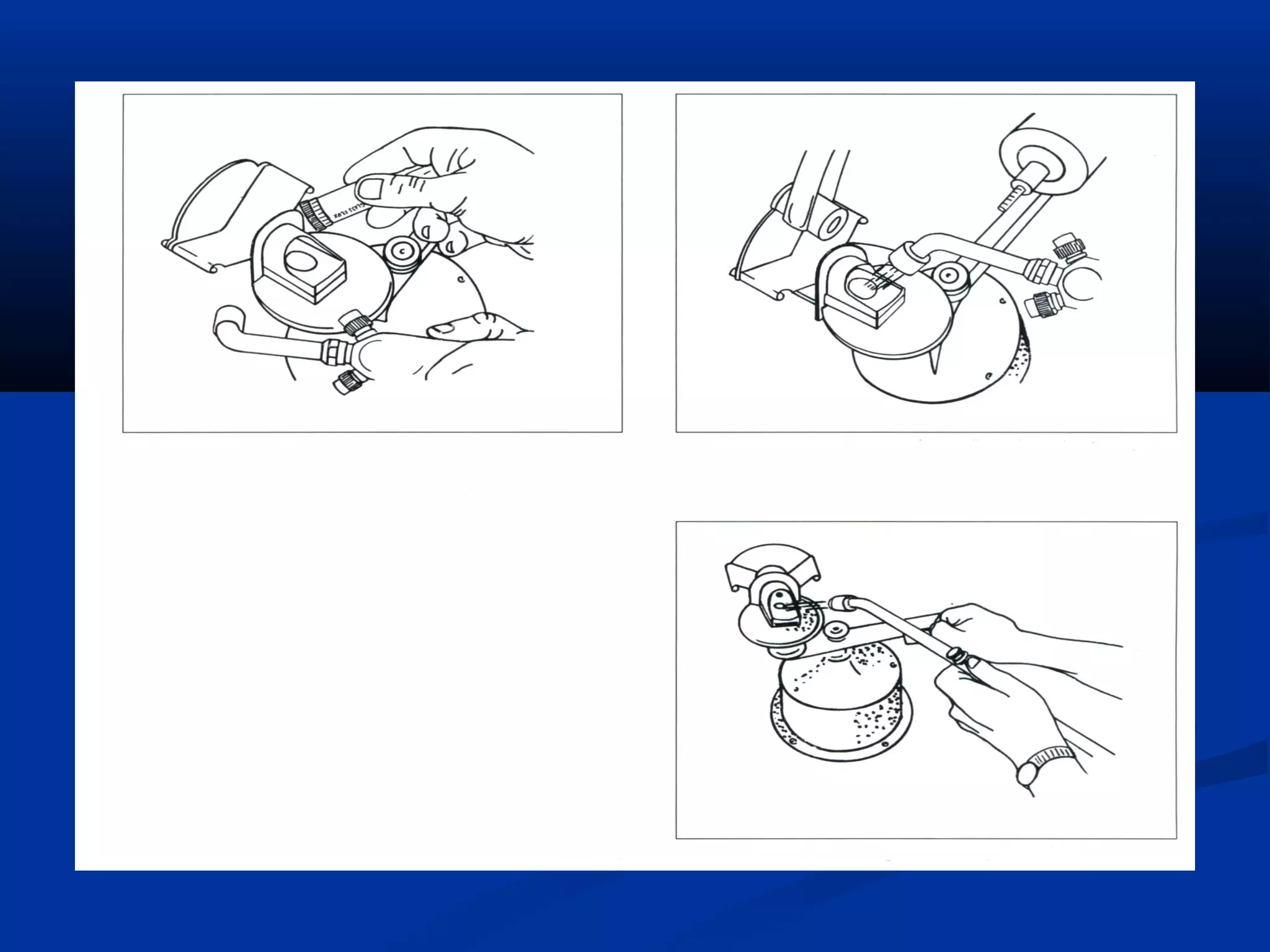 Spruing and investing