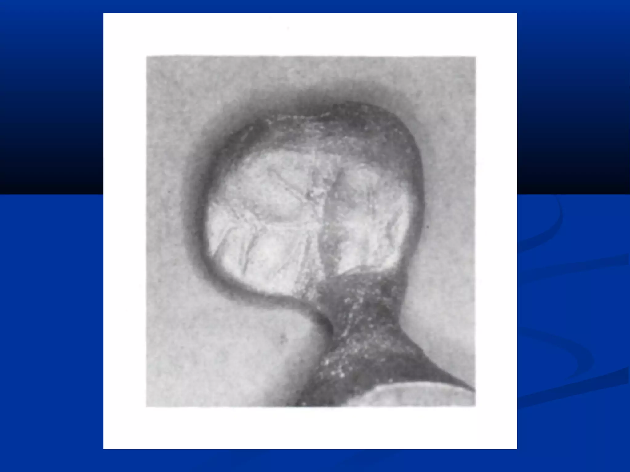 Spruing and investing