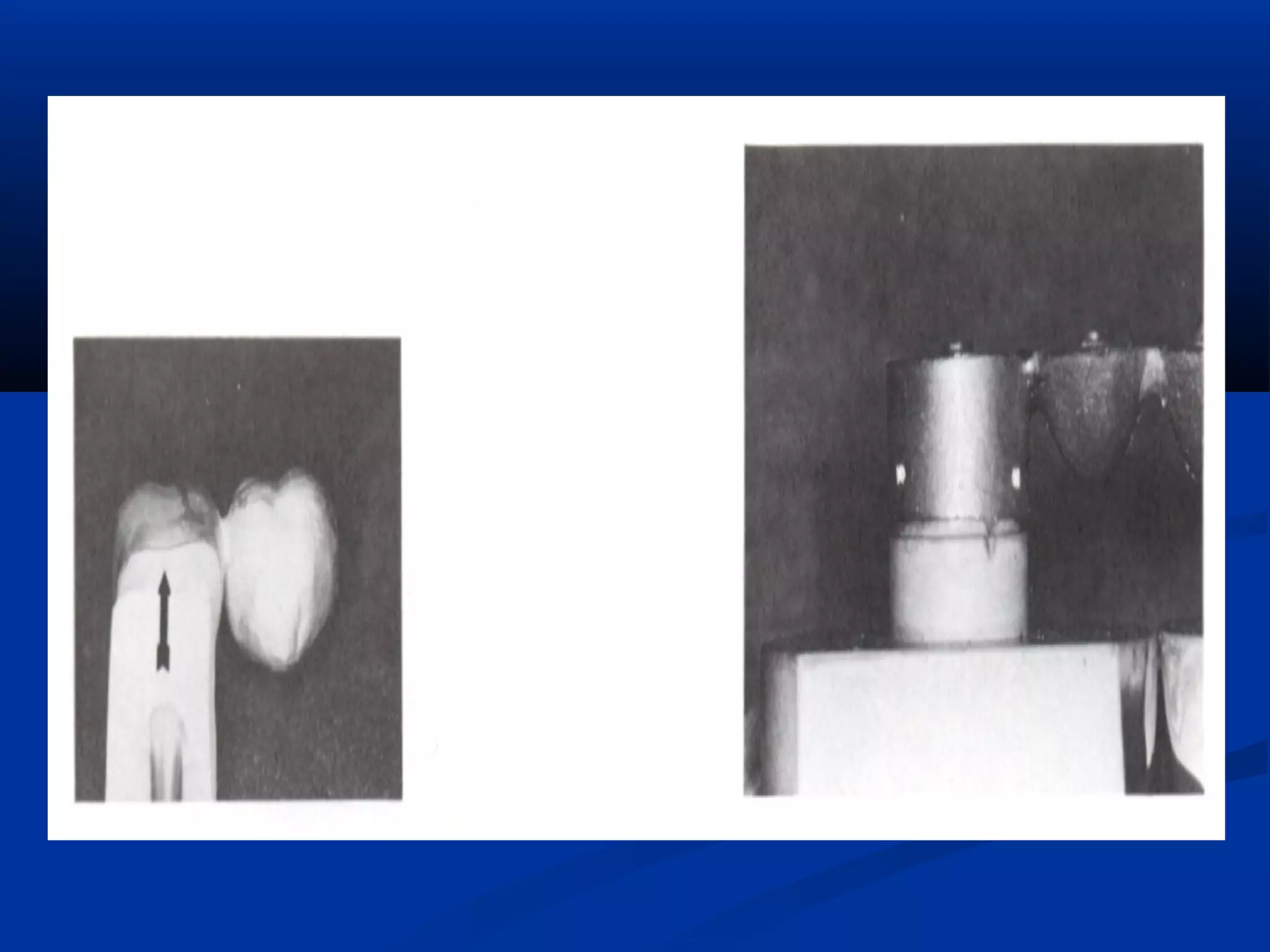 Spruing and investing