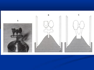 Spruing and investing