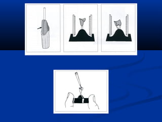 Spruing and investing