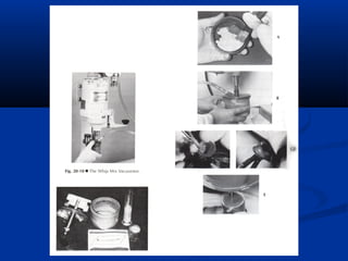 Spruing and investing