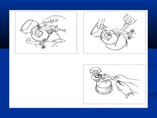 Spruing and investing