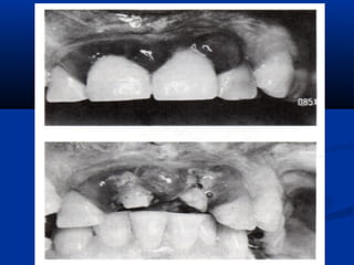 Spruing and investing